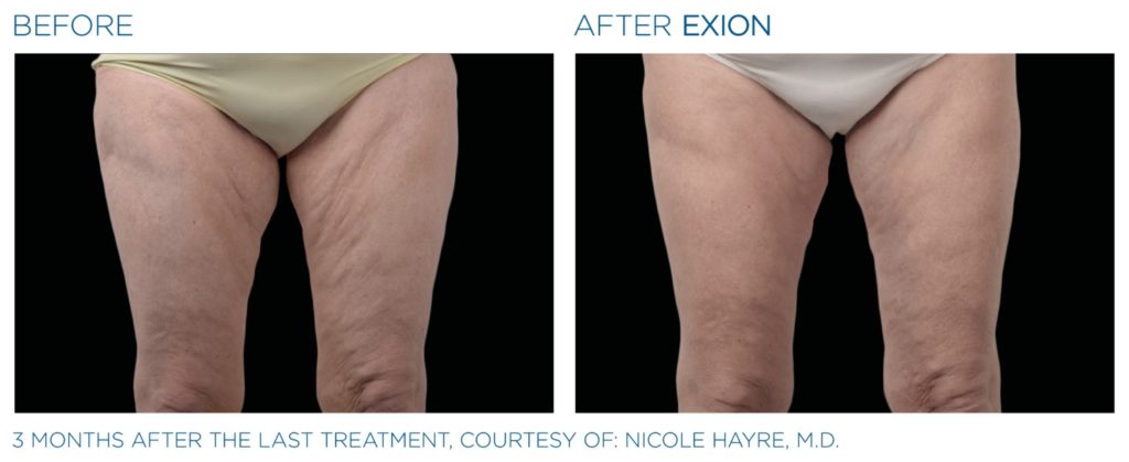 Solutions pour le visage et le corps EXION au Luxembourg